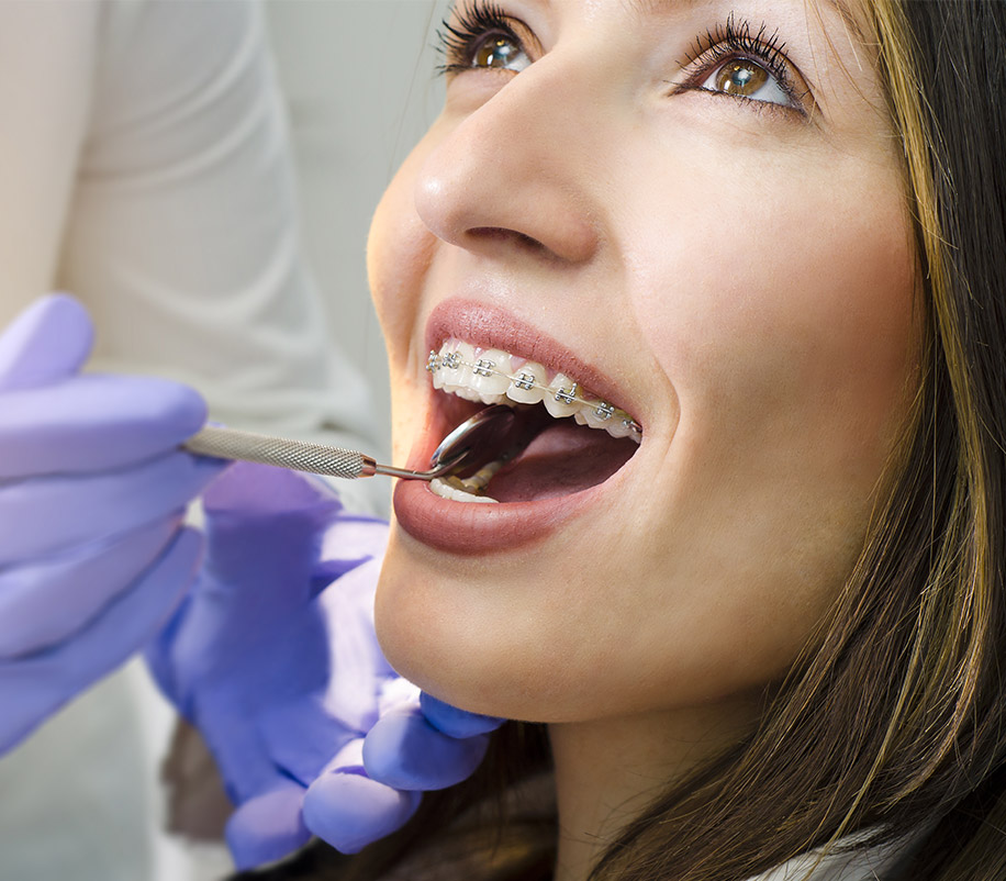 Ortodonzia | Studi Odontoiatrici White Trento